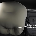 Next-Generation Airbags on the All-New Ford Focus